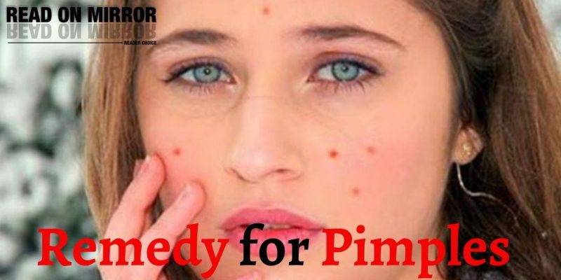 पिंपल हटाने के 20 घरेलू उपाय- How To Remove Pimples। ट्रीटमेंट, बचाव, डाइट
