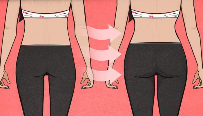 हिप्स सर्जरी करा सकते हैं - Hips Surgery for Big Bum in Hindi