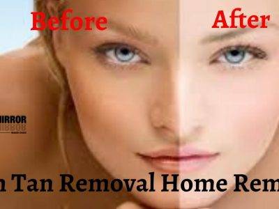 टैनिंग दूर करने के घरेलू 20 उपाय -Tan removal home remedy in Hindi। Best D Tan Pack