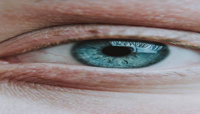 आंखों के नीचे से झुर्रिया हटाने के घरेलु उपाय - Home remedies for Wrinkles Under Eyes in Hindi