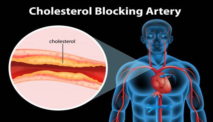 क्या है कोलेस्ट्रॉल - What is The Meaning of Cholesterol in Hindi