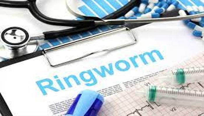 दाद खाज खुजली की दवा और इलाज - Treatment And Medicine of Ringworm in Hindi