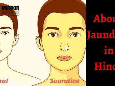 Jaundice क्यों होता है? Piliya के लक्षण, कारण, 12 उपाय और इलाज। About Jaundice in Hindi